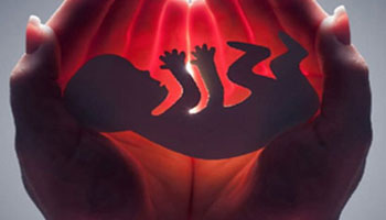 Medical Termination of Pregnancy