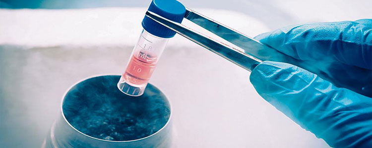 Stem Cell Banking